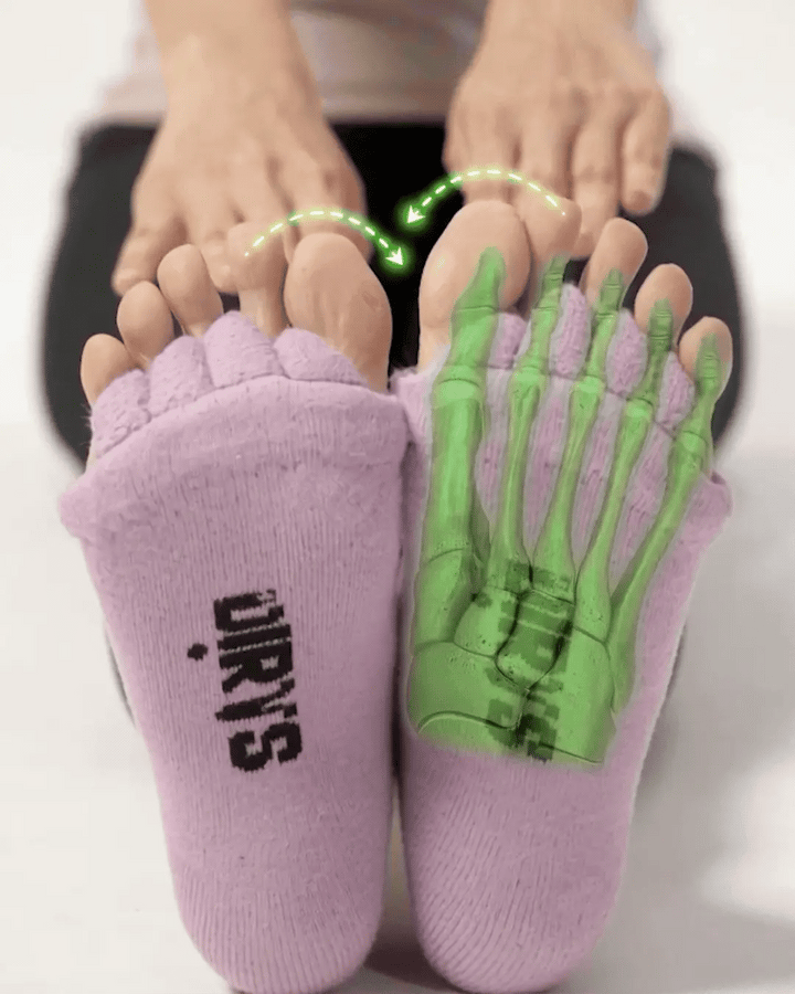 X-ray toe separation graphic — before / after